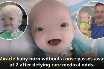 बिना नाक के पैदा हुआ ‘चमत्कारी बच्चा’ — 2 साल तक मौत को दी मात, फिर हुआ दिल तोड़ने वाला अंत